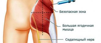 Актовегин (уколы \ таблетки)