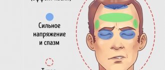 боль напряжения