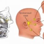 Neuralgia pain can be very painful