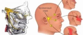 Neuralgia pain can be very painful