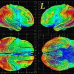 Alzheimer&#39;s disease