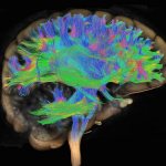 headlight disease symptoms