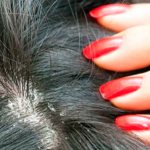 бородавка под волосами