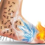 What is polyneuritis and how is it treated?