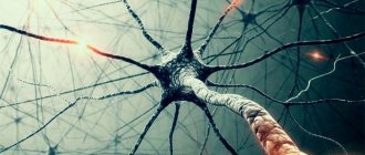 Demiliated brain disease