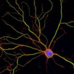 дендриты это