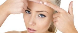 dermotillomania