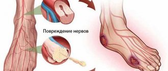 Diabetic microangiopathy is a manifestation of diabetes mellitus