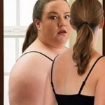 Дисморфофобия