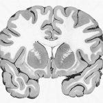 long processes of neuron cell bodies