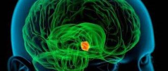 Benign brain tumor