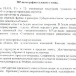 Single lesions in the white matter of the brain