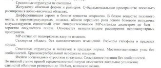Единичные очаги в белом веществе головного мозга