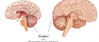 Epiphysis (pineal gland)