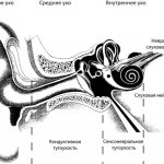 Этиология, симптомы, диагностика и методы лечения невриномы слухового нерва