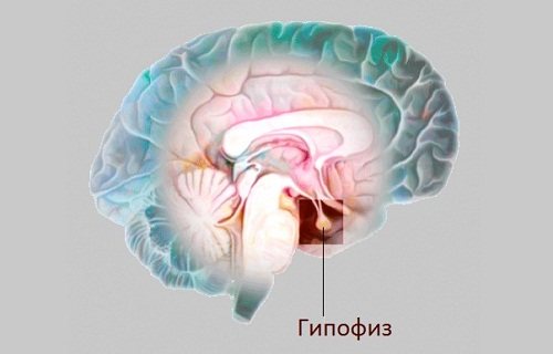 Аденома гипофиза головного мозга: признаки у мужчин и женщин