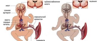 гипоксия при родах