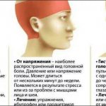 Головные боли в затылке и в висках