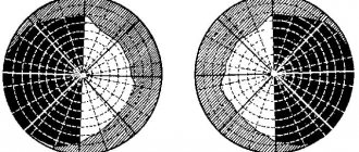 homonymous hemianopsia