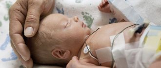 Cardiac ischemia in newborns