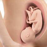 hysterical pregnancy