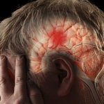 Image 1 Restoring motor skills after a stroke - Verimed