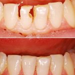 Как пройти мрт если боишься замкнутого пространства