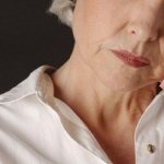 Menopausal neurosis with vegetative-vascular disorders