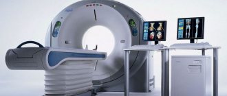CT scan