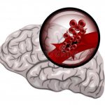Treatment of hemorrhagic stroke