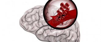 Treatment of hemorrhagic stroke