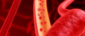 Treatment of cerebral atherosclerosis with drugs
