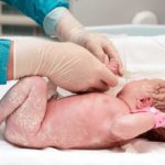 Лечение судорог у новорожденных