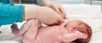 Лечение судорог у новорожденных