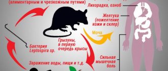 Лептоспироз симптомы