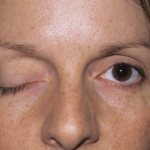 Лицо девушки