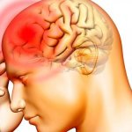 Meningitis. causes, symptoms, diagnosis and treatment 