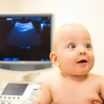 межполушарная щель