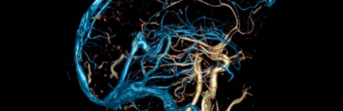 Дисциркуляторная энцефалопатия 3 степени (ДЭП): сколько можно прожить ...