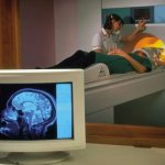 head mri