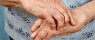 multifocal progressive leukoencephalopathy late symptoms