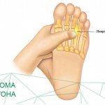 Morton&#39;s neuroma (foot): causes, symptoms, treatment methods