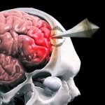 Повреждение