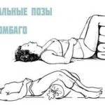 Позы при люмбаго