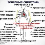 Causes, symptoms and treatment of cardiac neurosis - review of pathology