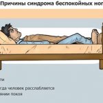 Причины синдрома беспокойных ног