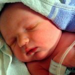 pseudocyst in the head of a newborn: causes