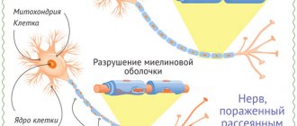 Multiple sclerosis