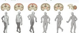 How long do people live with cerebral palsy?