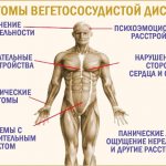 Vegetative-vascular dystonia (VSD): symptoms